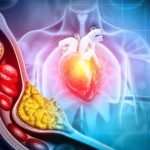 Makanan Penurun Kolesterol yang Ampuh untuk Jantung Sehat