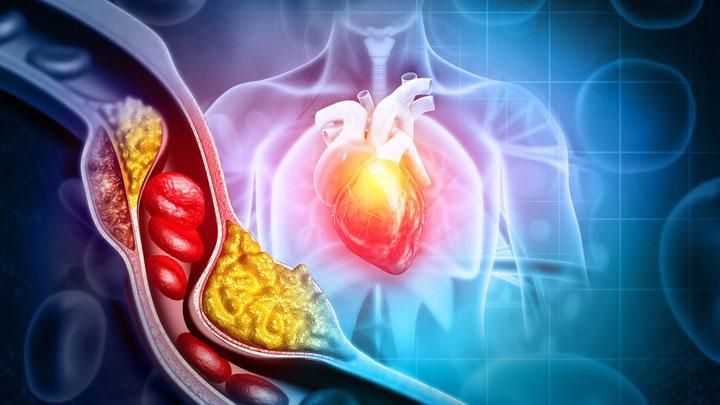 Makanan Penurun Kolesterol yang Ampuh untuk Jantung Sehat