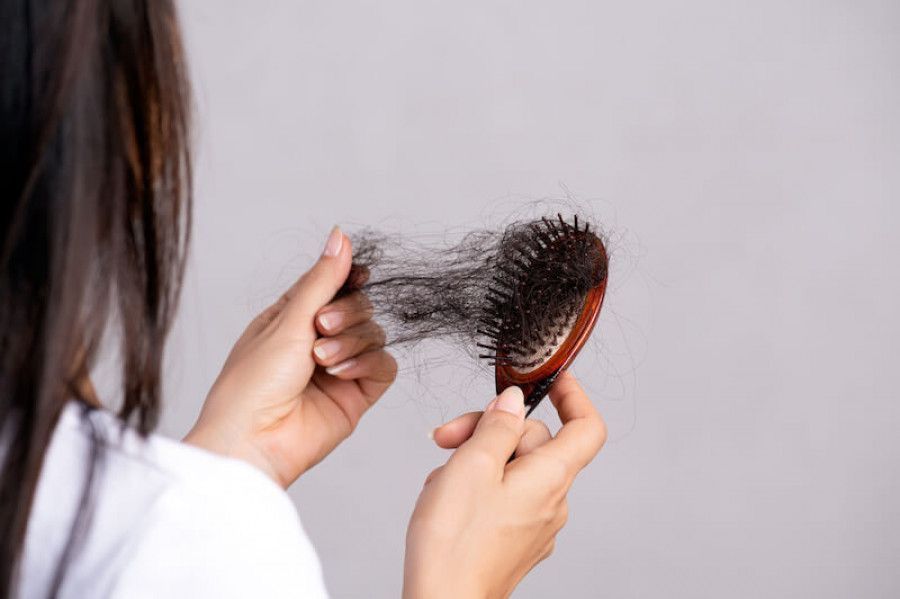 9 Cara Mengatasi Rambut Rontok Paling Ampuh & Anti Galau
