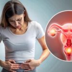 Ciri-Ciri PCOS pada Wanita yang Wajib Dikenali Sejak Dini