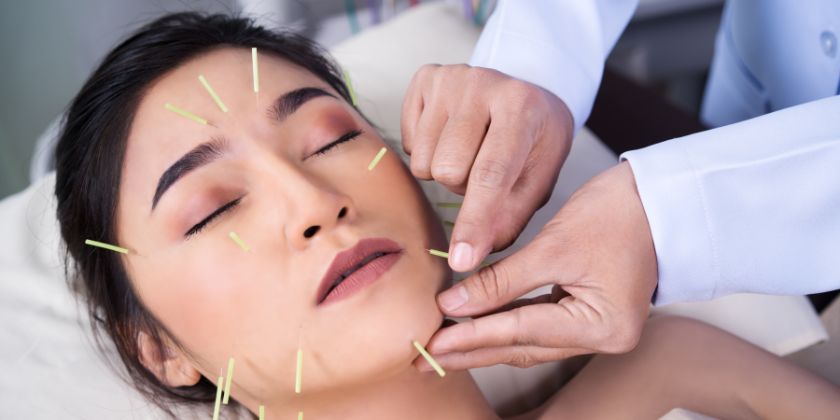 Akupuntur Facelift Rahasia Awet Muda Alami dan Aman