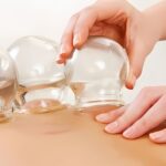 Terapi Bekam: Manfaat, Prosedur, dan Efeknya Lengkap