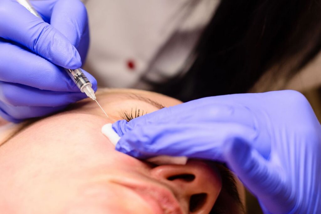 Cara Menghilangkan Milia dengan Aman, Ini Treatment Efektif