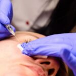 Cara Menghilangkan Milia dengan Aman, Ini Treatment Efektif