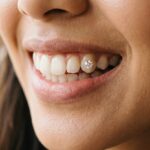 Tooth Gem Jadi Tren Gen Z, Aman atau Berisiko