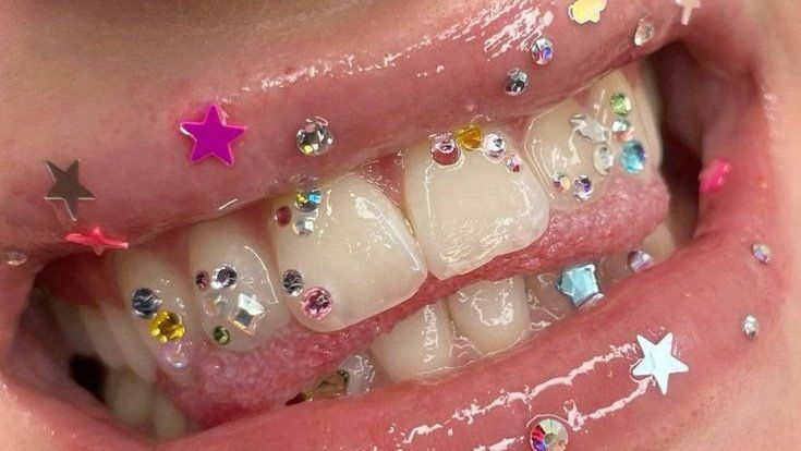 Tooth Gem Jadi Tren Gen Z, Aman atau Berisiko
